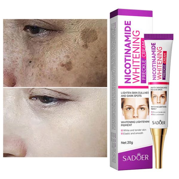 Nicotinamide Whitening Freckles Cream