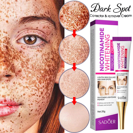 Nicotinamide Whitening Freckles Cream