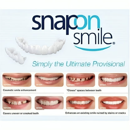 Snap-On Smile Custom Fit Perfect Smile Veneers In 3 Easy Steps