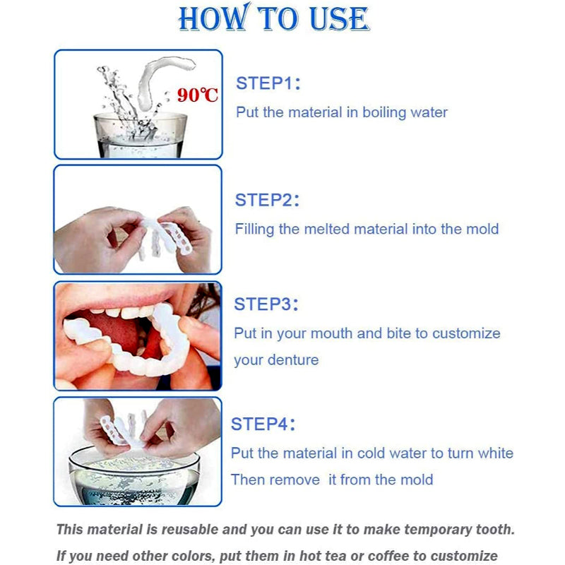 Snap-On Smile Custom Fit Perfect Smile Veneers In 3 Easy Steps