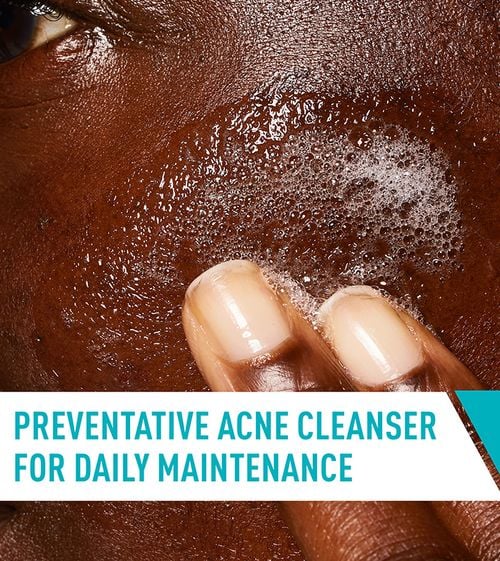 Cerave Acne Control Cleanser