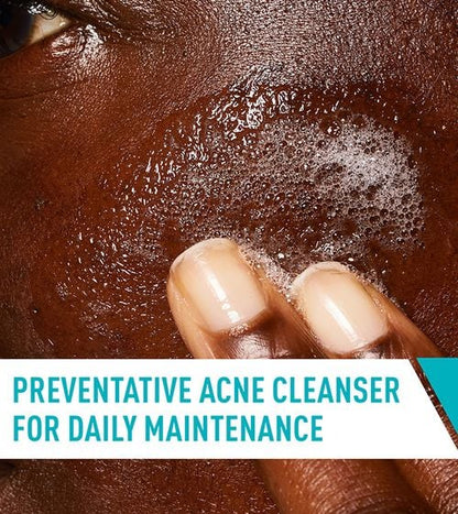 Cerave Acne Control Cleanser