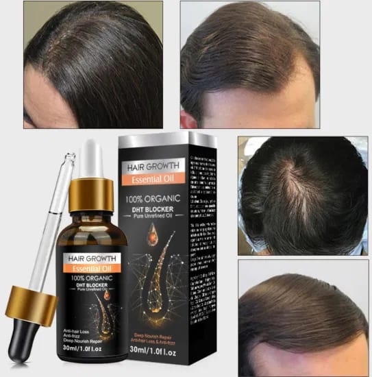 Ginger Hair Care Growth Serum Deep Nourish Repair Prevent Thinning Hair Dry Frizzy Essence Anti Hair Loss Essential Oil