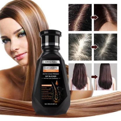 Hair Growth Ginger Shampoo Biotin Cold-pressed Anti-hair Loss Conditioner Massage Cream Hair Treatment Skin Care Product